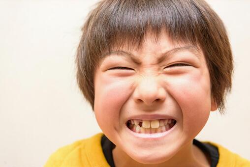 船堀（東京都江戸川区）の歯医者のRANPA矯正治療