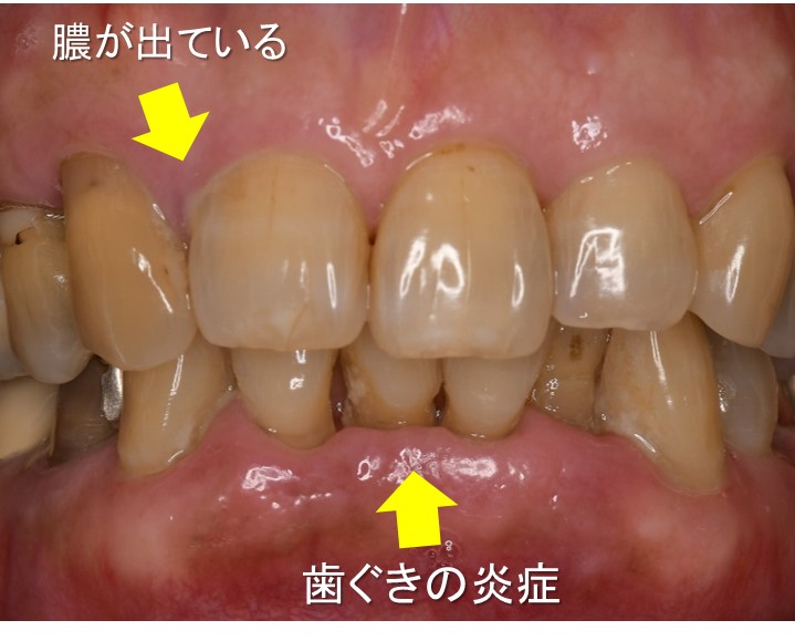 船堀（東京都江戸川区）の歯医者で予防歯科